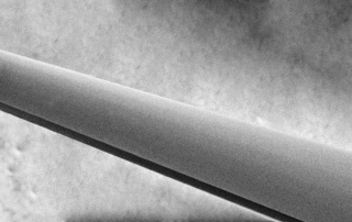 Laser turning medical technology